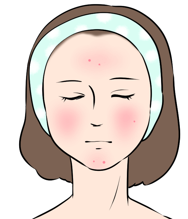 ニキビ肌